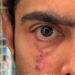 Abhishek Banerjee’s ‘scar’ post sparks political buzz amid US eye treatment
