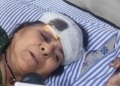 ‘Was travelling with my husband… don’t know where he is now’: Victim of Greater Noida bus fire
